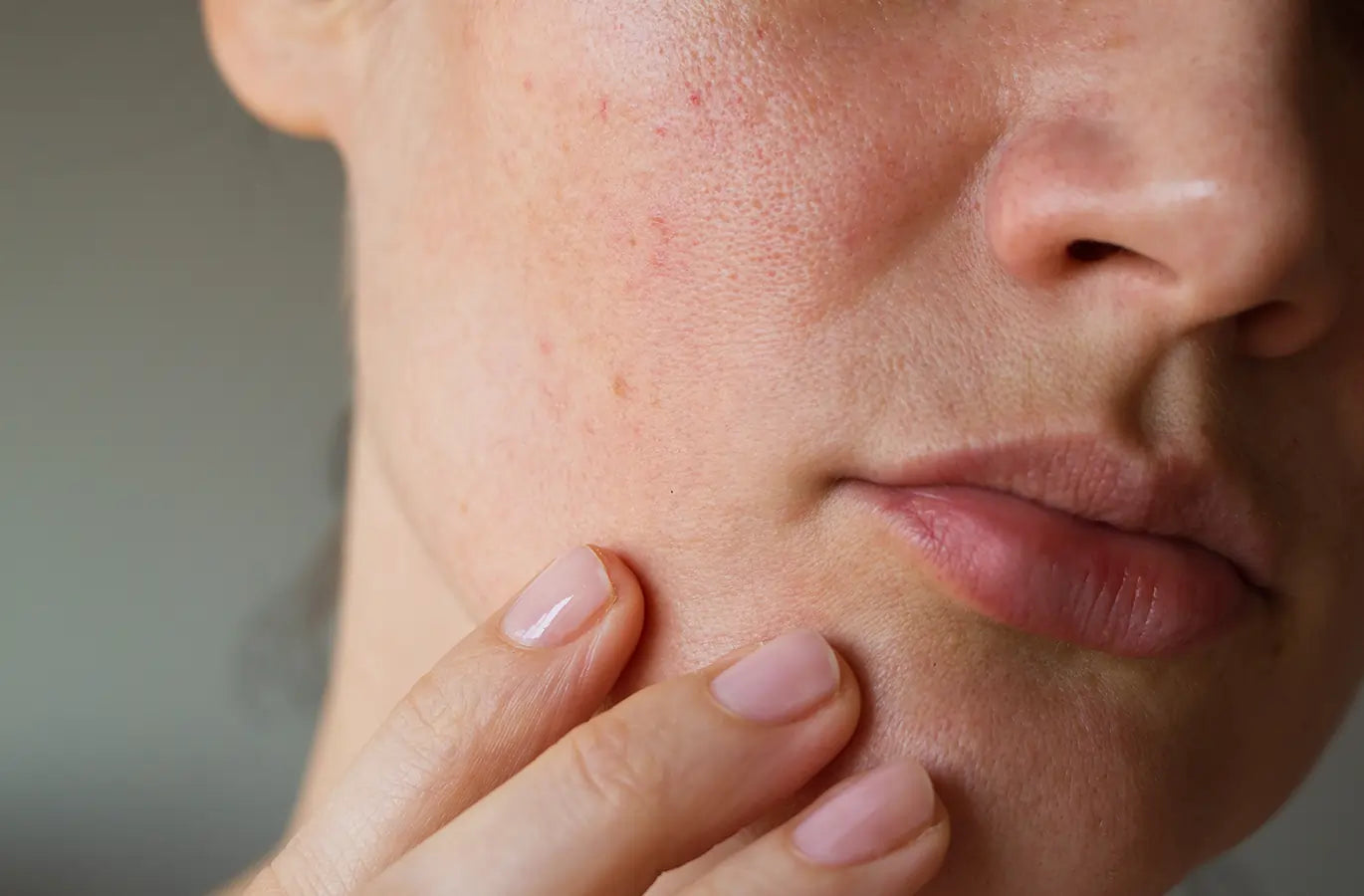 Balanced skin barrier