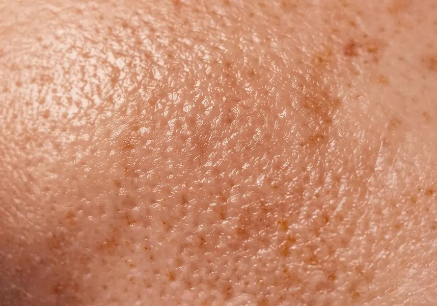 How to Support Your Skin Microbiome