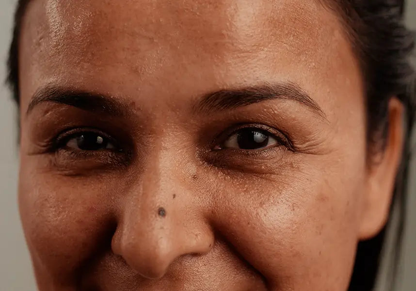 My Skin Journey: A Story Worth Telling