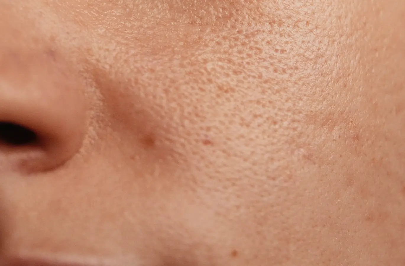 Skin microbiome pores