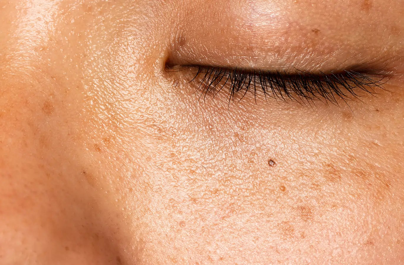 Skin supported by the microbiome