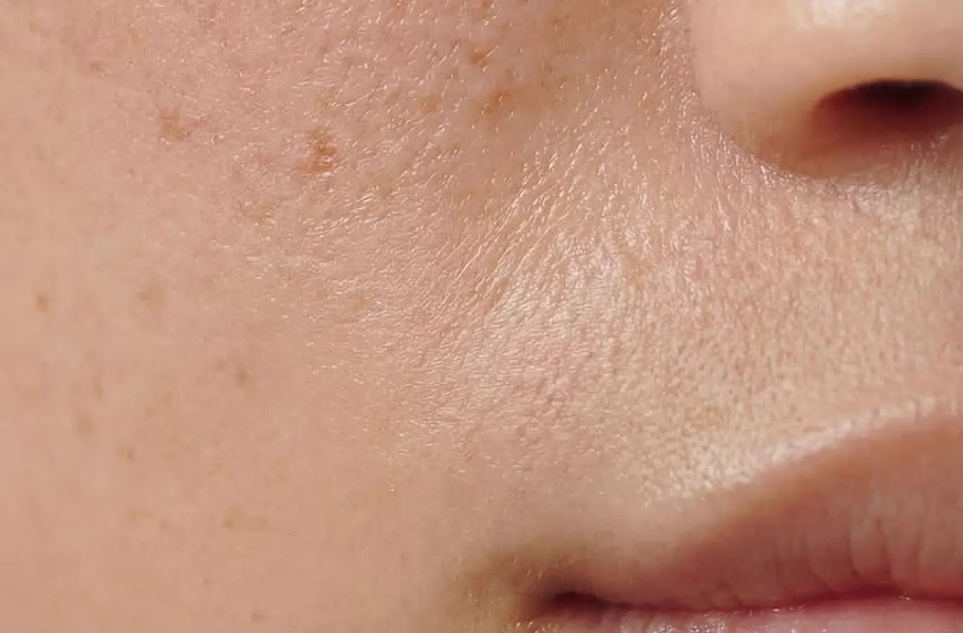 Skin responding to fewer variables