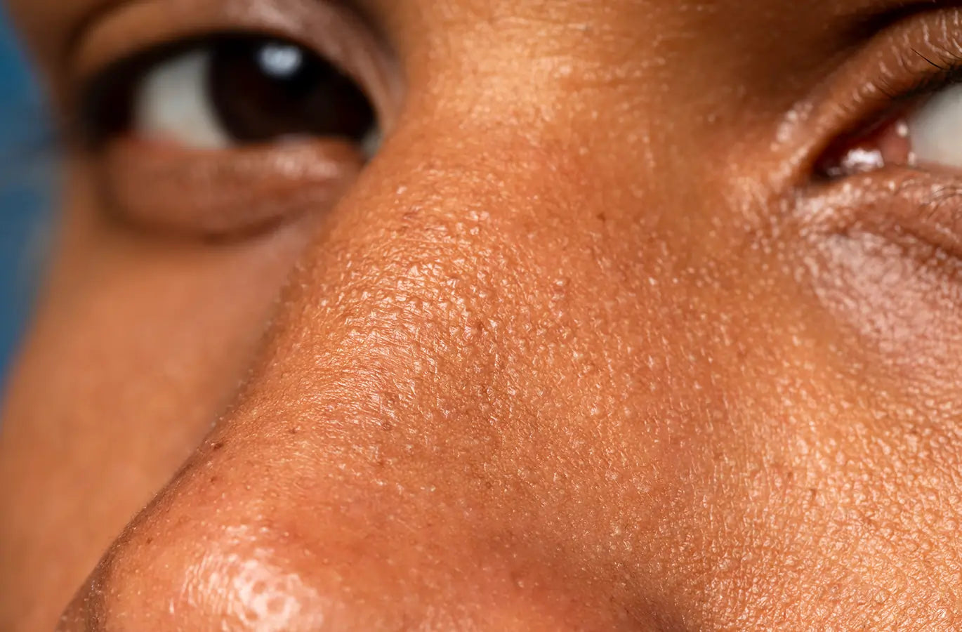 Skin behaviour varies