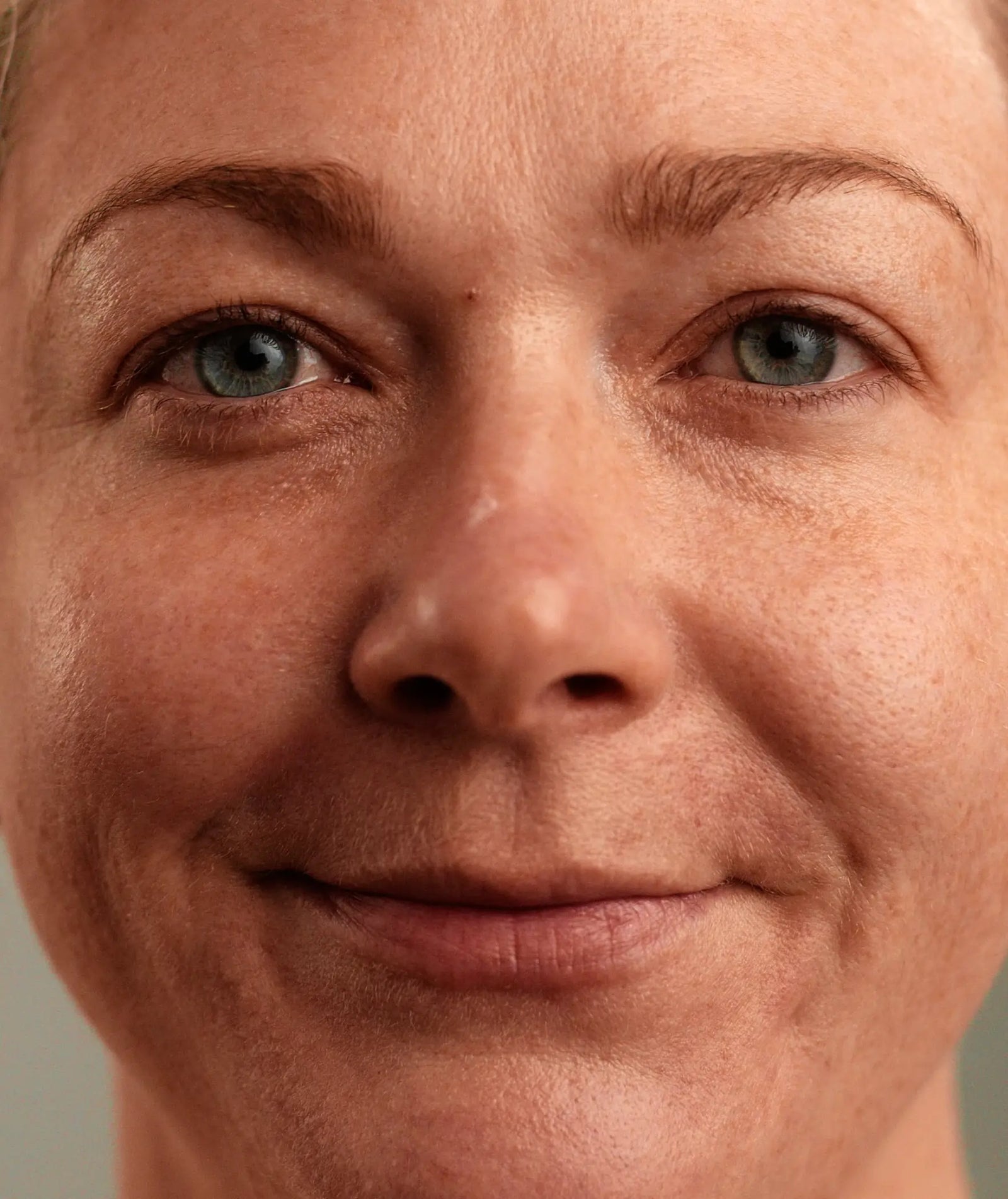 Skin barrier and balance of healthy skin
